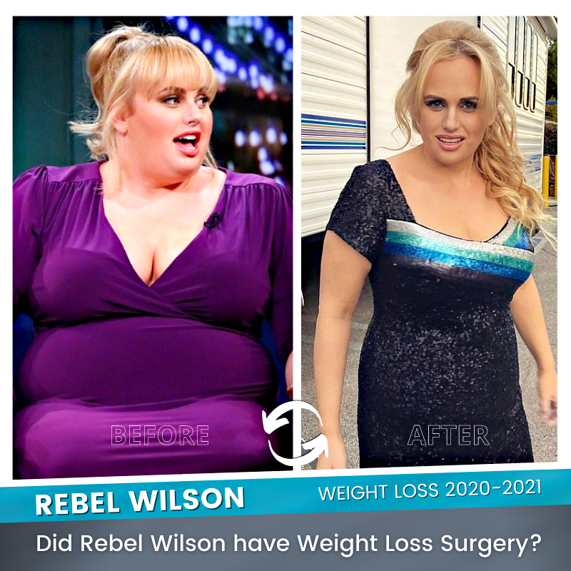 Rebel Wilson’s Dramatic Weight Loss: The Controversial ‘Mayr Method’ Explained